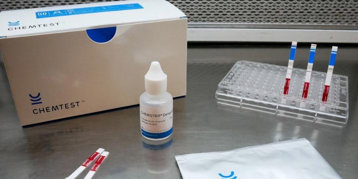 Argentinian Scientists Develop Kit That Diagnoses Dengue in Just 10 Minutes